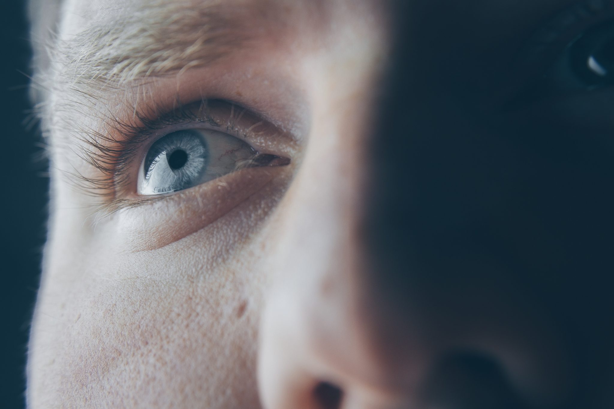 Comment traiter la sécheresse oculaire (ou xérophtalmie) ? - Anno Santé